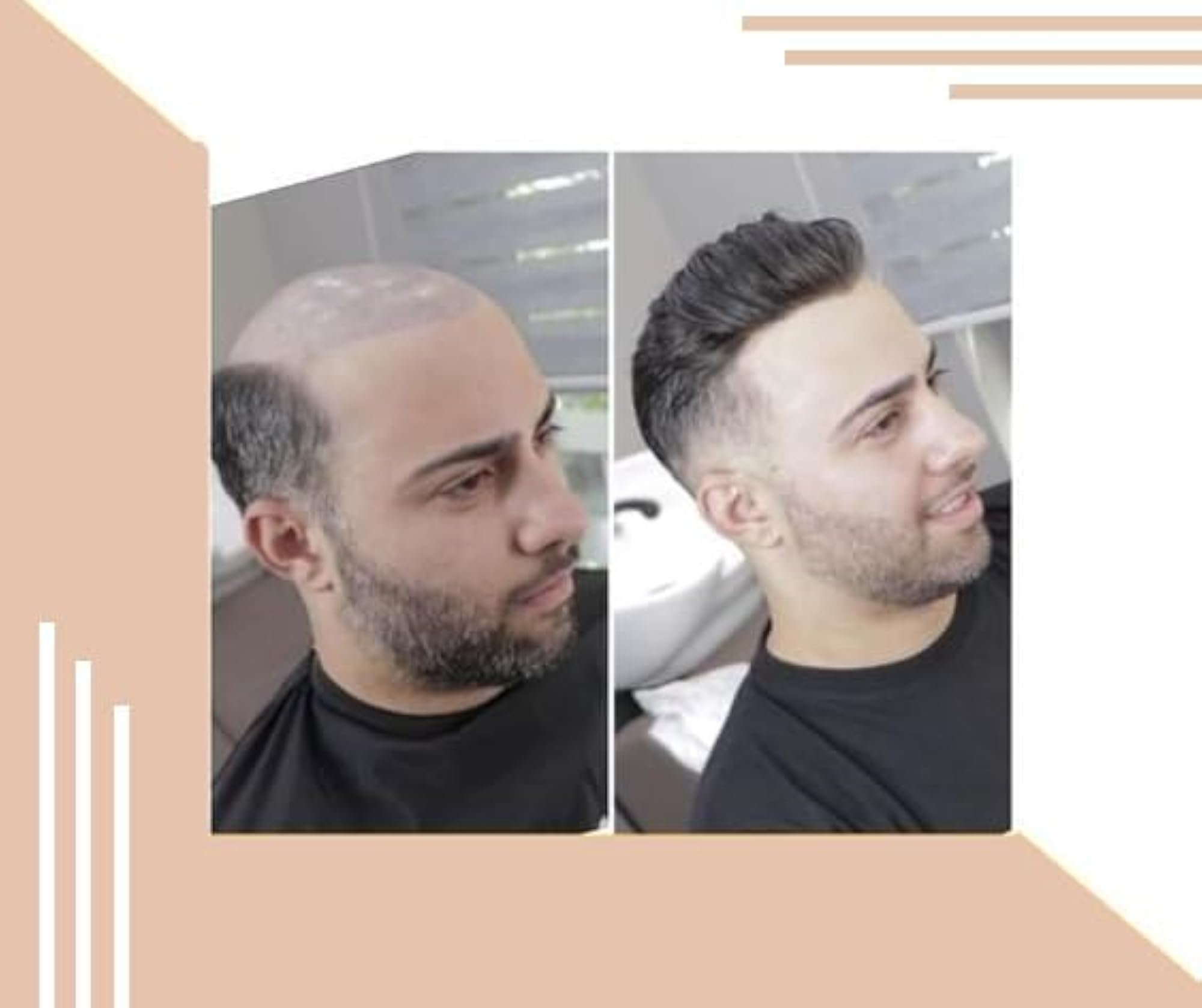 Men's Monofilament Human Hair Patch Toupee Wig